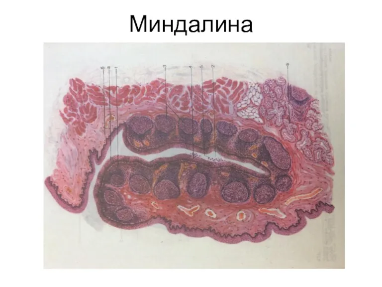 Миндалина