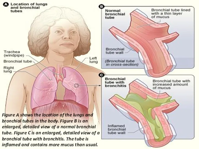 Figure A shows the location of the lungs and bronchial tubes in the