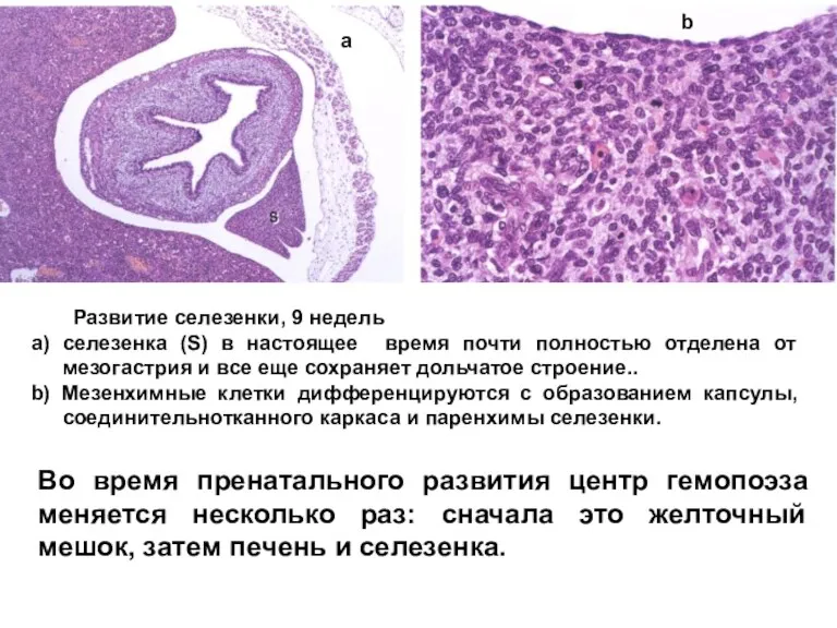 Развитие селезенки, 9 недель a) селезенка (S) в настоящее время