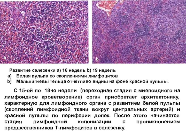 Развитие селезенки a) 16 недель b) 19 недель Белая пульпа
