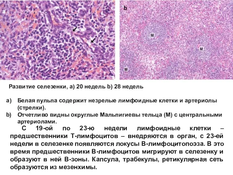 Развитие селезенки, a) 20 недель b) 28 недель Белая пульпа