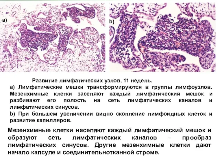 Развитие лимфатических узлов, 11 недель. a) Лимфатические мешки трансформируются в