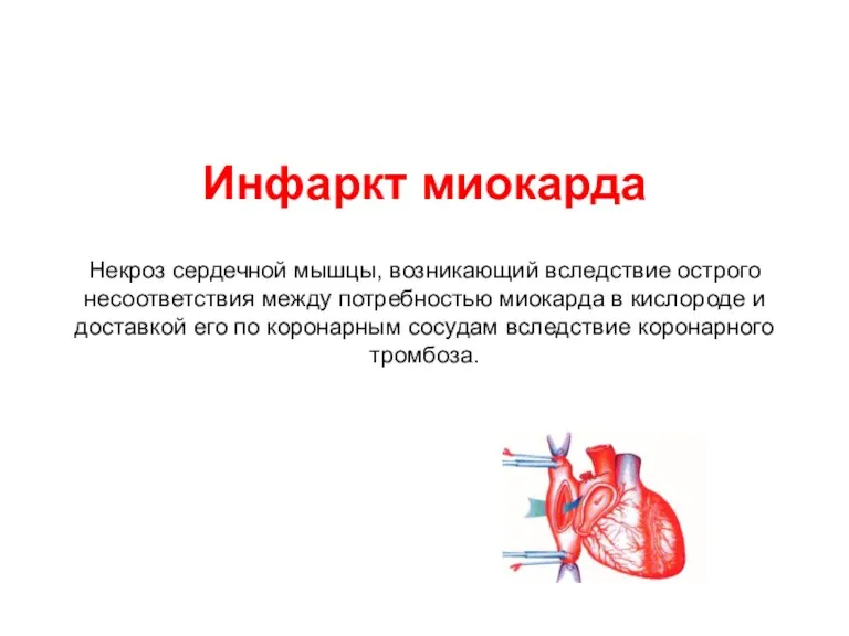 Инфаркт миокарда Некроз сердечной мышцы, возникающий вследствие острого несоответствия между