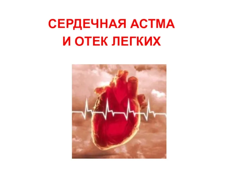 СЕРДЕЧНАЯ АСТМА И ОТЕК ЛЕГКИХ