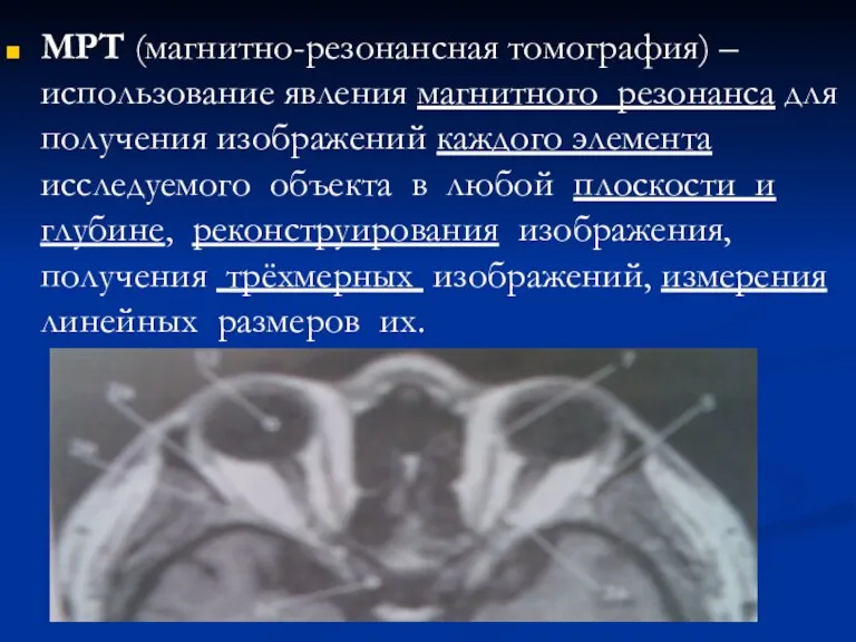 МРТ (магнитно-резонансная томография) – использование явления магнитного резонанса для получения изображений каждого элемента