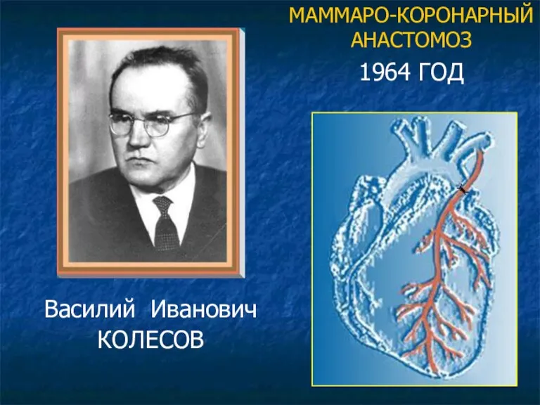 МАММАРО-КОРОНАРНЫЙ АНАСТОМОЗ 1964 ГОД Василий Иванович КОЛЕСОВ