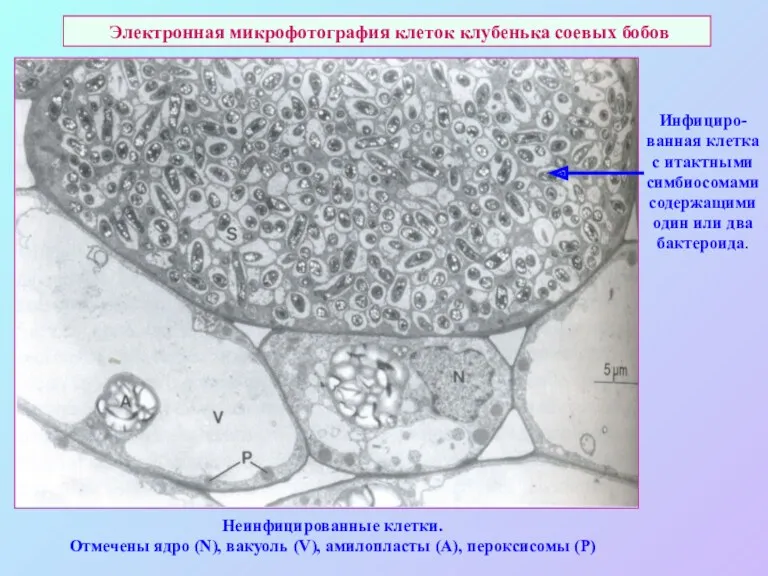Электронная микрофотография клеток клубенька соевых бобов Инфициро-ванная клетка с итактными симбиосомами содержащими один