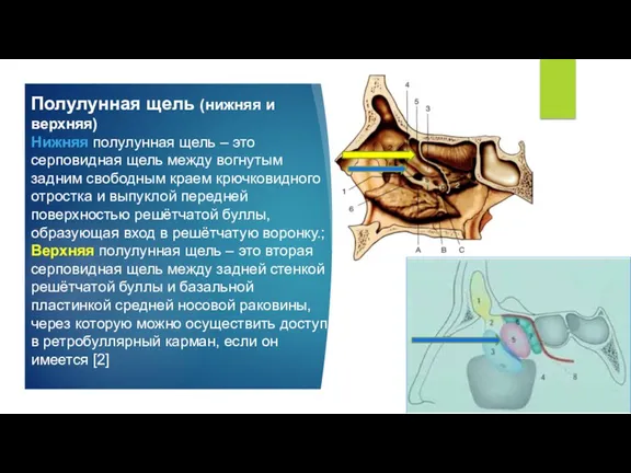 Полулунная щель (нижняя и верхняя) Нижняя полулунная щель – это