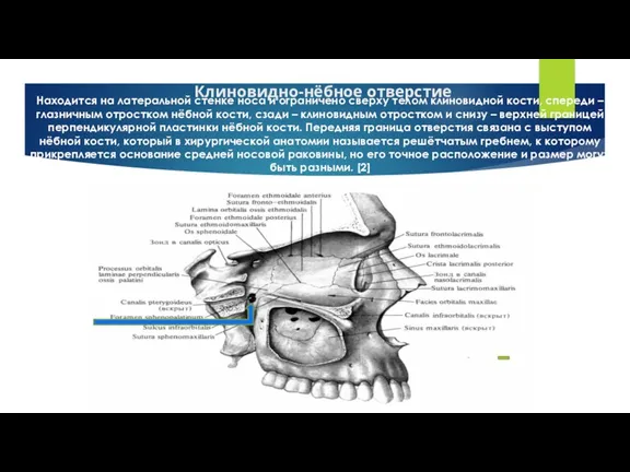 Клиновидно-нёбное отверстие Находится на латеральной стенке носа и ограничено сверху