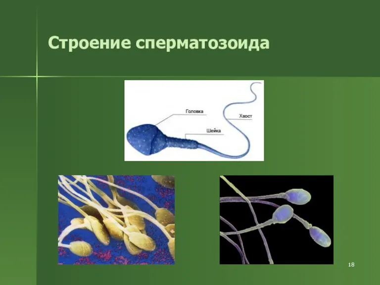 Строение сперматозоида