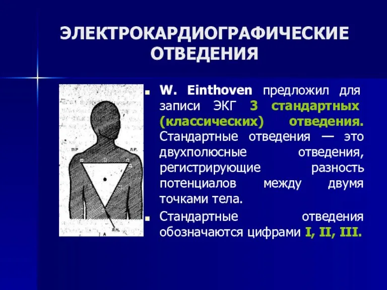 ЭЛЕКТРОКАРДИОГРАФИЧЕСКИЕ ОТВЕДЕНИЯ W. Einthoven предложил для записи ЭКГ 3 стандартных