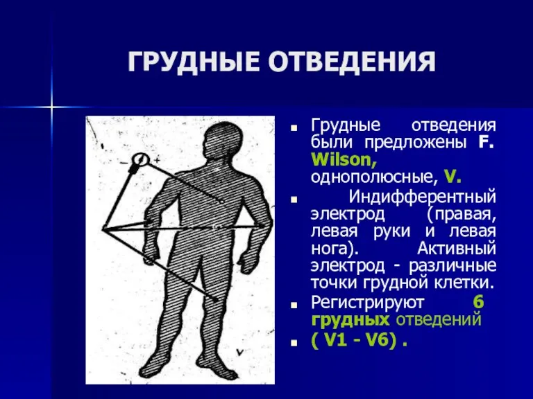 ГРУДНЫЕ ОТВЕДЕНИЯ Грудные отведения были предложены F. Wilson, однополюсные, V.