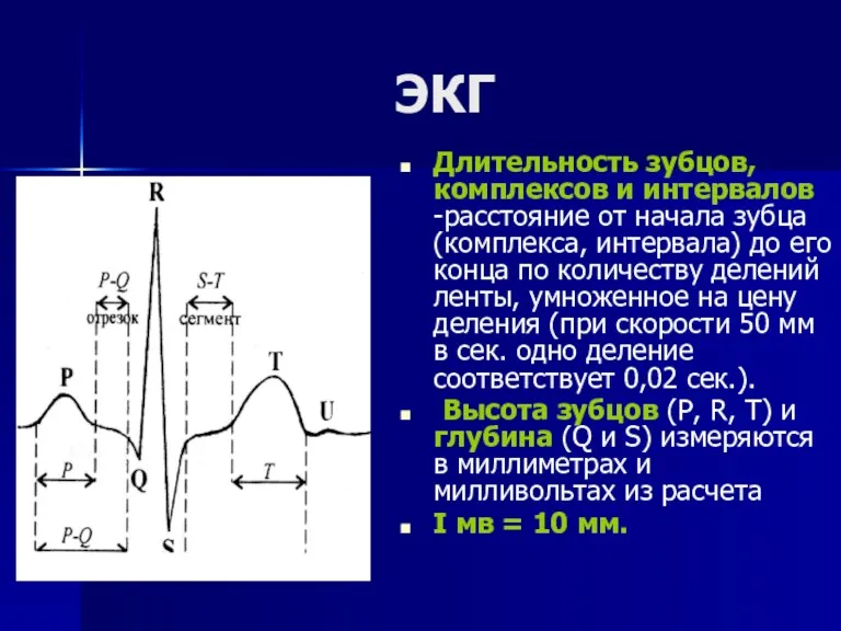 ЭКГ Длительность зубцов, комплексов и интервалов -расстояние от начала зубца