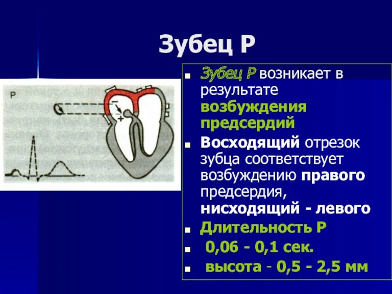 Зубец Р Зубец Р возникает в результате возбуждения предсердий Восходящий