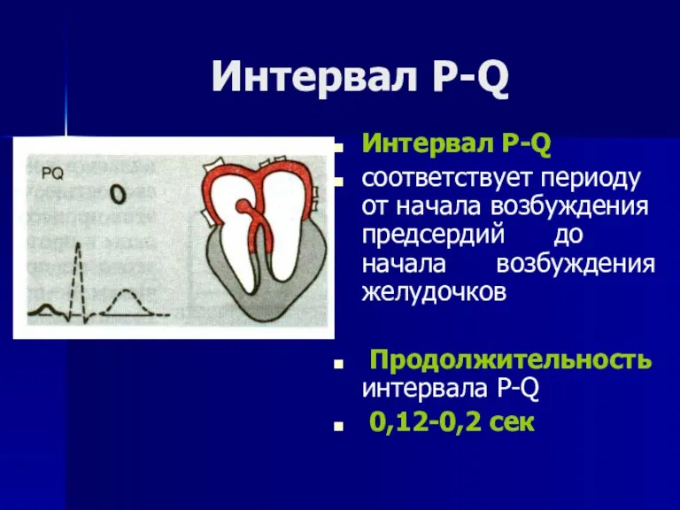 Интервал Р-Q Интервал Р-Q соответствует периоду от начала возбуждения предсердий