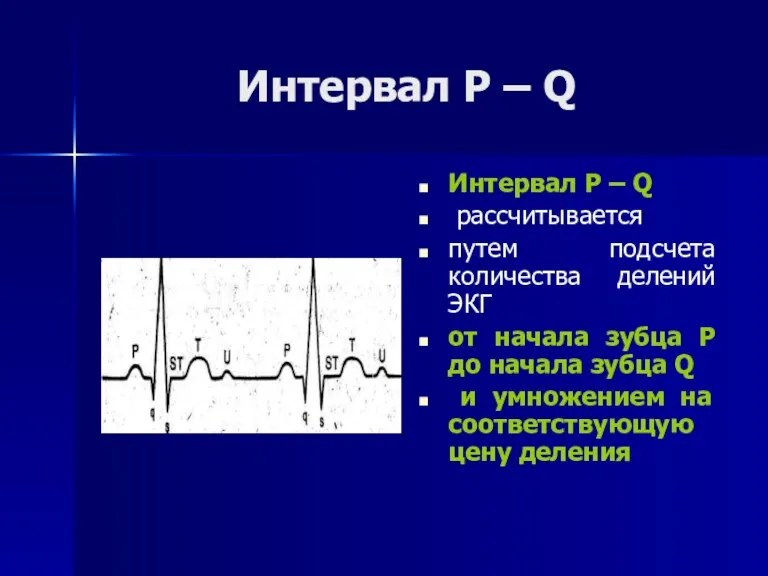 Интервал Р – Q Интервал Р – Q рассчитывается путем