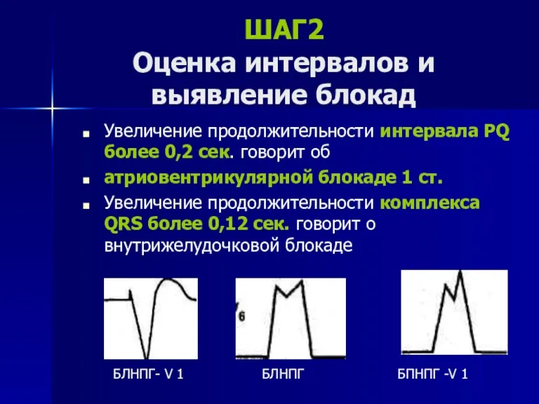 ШАГ2 Оценка интервалов и выявление блокад Увеличение продолжительности интервала РQ