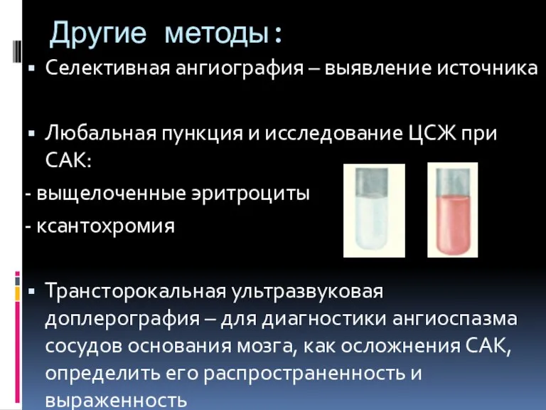 Другие методы: Селективная ангиография – выявление источника Любальная пункция и