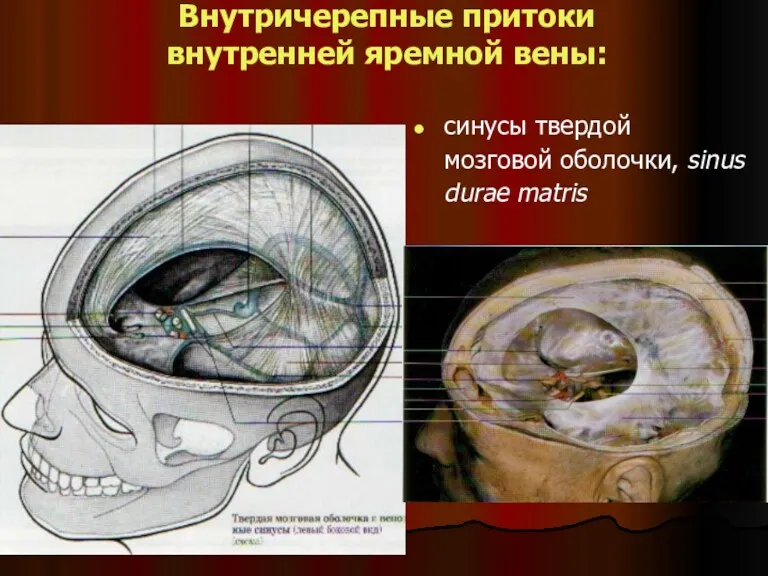 Внутричерепные притоки внутренней яремной вены: cинусы твердой мозговой оболочки, sinus durae matris