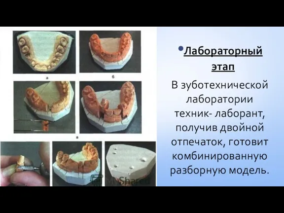 Лабораторный этап В зуботехнической лаборатории техник- лаборант, получив двойной отпечаток, готовит комбинированную разборную модель.