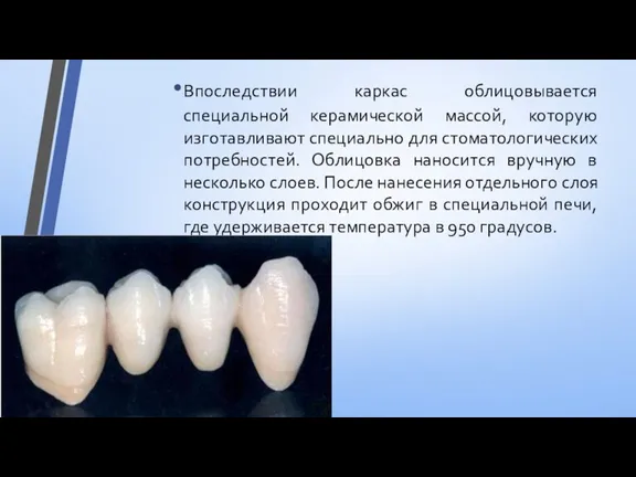 Впоследствии каркас облицовывается специальной керамической массой, которую изготавливают специально для