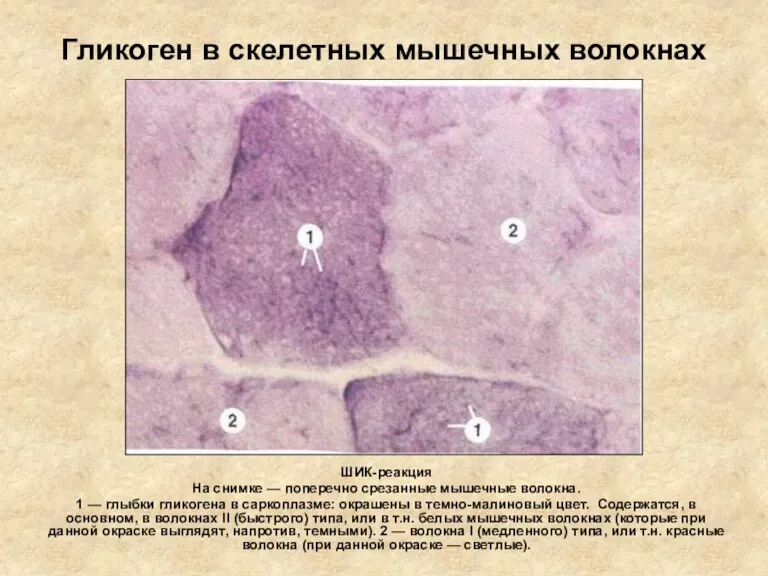 Гликоген в скелетных мышечных волокнах ШИК-реакция На снимке — поперечно