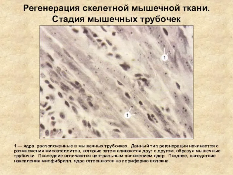 Регенерация скелетной мышечной ткани. Стадия мышечных трубочек 1 — ядра,