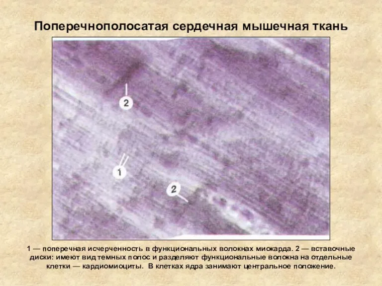 Поперечнополосатая сердечная мышечная ткань 1 — поперечная исчерченность в функциональных