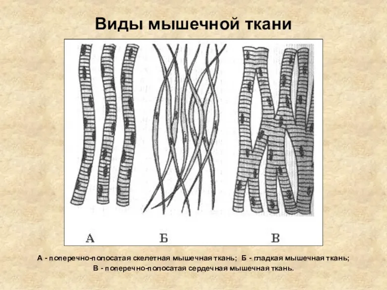 Виды мышечной ткани А - поперечно-полосатая скелетная мышечная ткань; Б