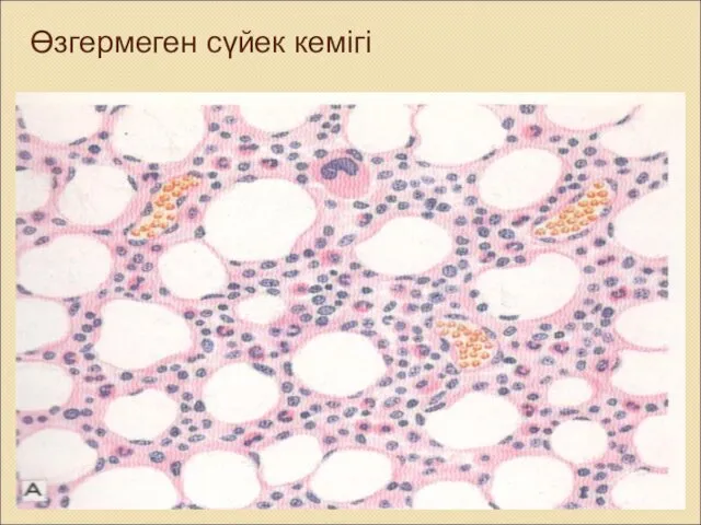 Өзгермеген сүйек кемігі