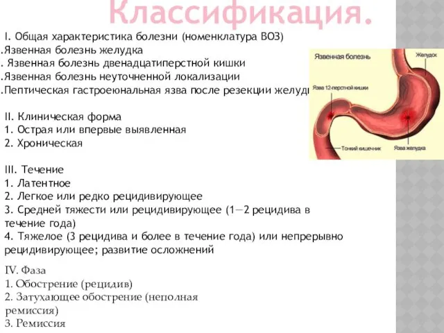 Классификация. I. Общая характеристика болезни (номенклатура ВОЗ) Язвенная болезнь желудка Язвенная болезнь двенадцатиперстной