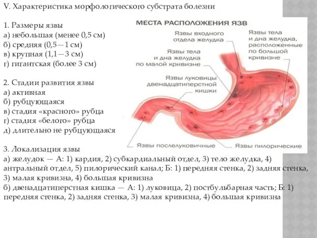 V. Характеристика морфологического субстрата болезни 1. Размеры язвы а) небольшая (менее 0,5 см)