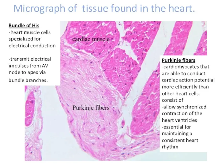 Micrograph of tissue found in the heart. Bundle of His