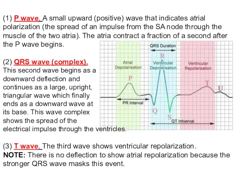 (1) P wave. A small upward (positive) wave that indicates