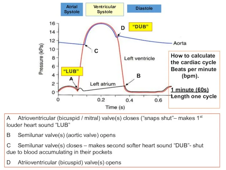 A Atrioventricular (bicuspid / mitral) valve(s) closes (“snaps shut”– makes