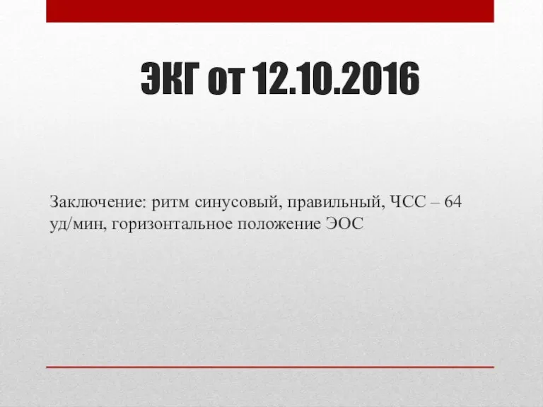 ЭКГ от 12.10.2016 Заключение: ритм синусовый, правильный, ЧСС – 64 уд/мин, горизонтальное положение ЭОС