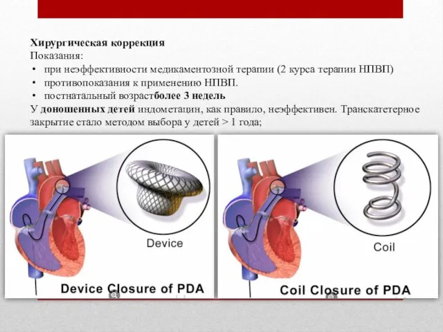 Хирургическая коррекция Показания: при неэффективности медикаментозной терапии (2 курса терапии