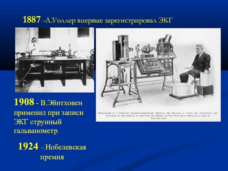 1908 - В.Эйнтховен применил при записи ЭКГ струнный гальванометр 1924