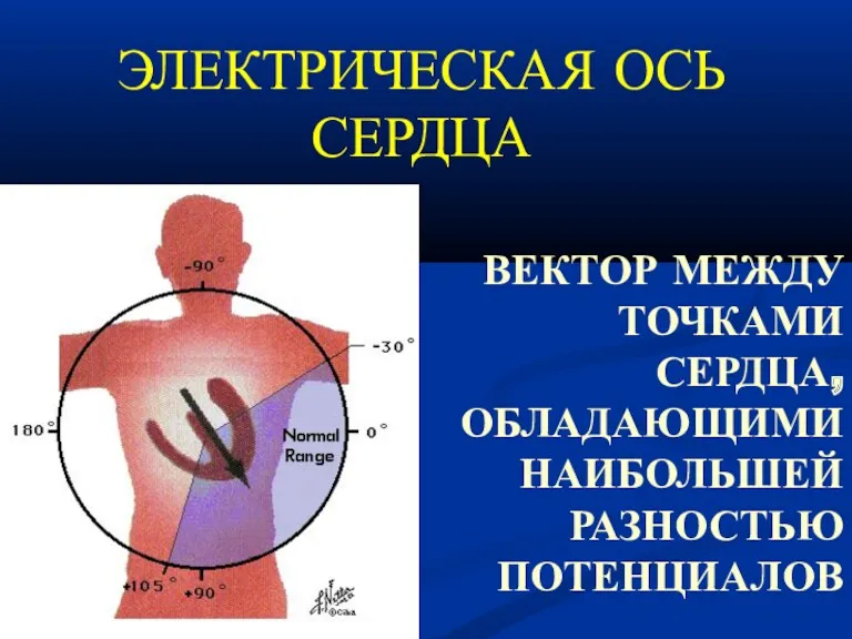 ЭЛЕКТРИЧЕСКАЯ ОСЬ СЕРДЦА ВЕКТОР МЕЖДУ ТОЧКАМИ СЕРДЦА, ОБЛАДАЮЩИМИ НАИБОЛЬШЕЙ РАЗНОСТЬЮ ПОТЕНЦИАЛОВ