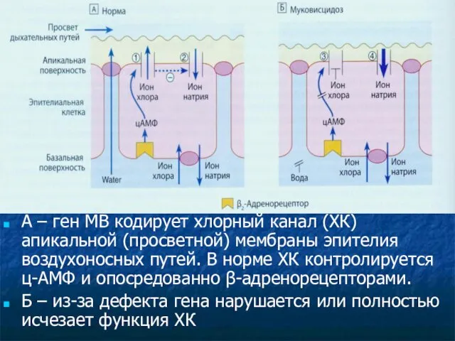 А – ген МВ кодирует хлорный канал (ХК) апикальной (просветной) мембраны эпителия воздухоносных