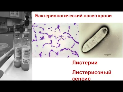 Бактериологический посев крови Листерии Листериозный сепсис