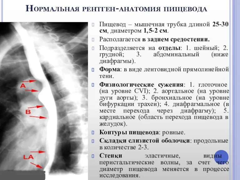 Нормальная рентген-анатомия пищевода Пищевод – мышечная трубка длиной 25-30 см,