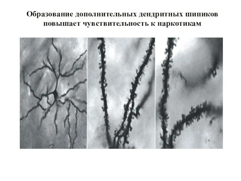 Образование дополнительных дендритных шипиков повышает чувствительность к наркотикам