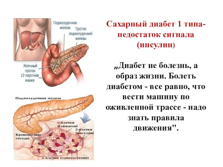 Сахарный диабет 1 типа- недостаток сигнала (инсулин) „Диабет не болезнь,