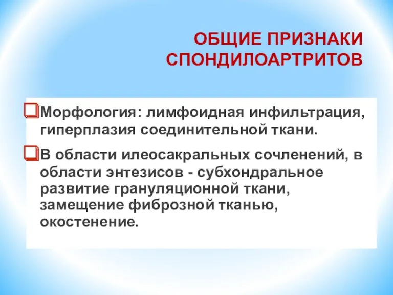 ОБЩИЕ ПРИЗНАКИ СПОНДИЛОАРТРИТОВ Морфология: лимфоидная инфильтрация, гиперплазия соединительной ткани. В