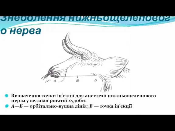 Знеболення нижньощелепового нерва Визначення точки ін'єкції для анестезії нижньощелепового нерва