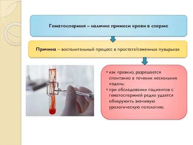 Гематоспермия – наличие примеси крови в сперме Причина – воспалительный
