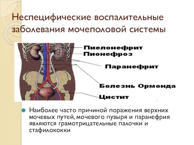 Неспецифические воспалительные заболевания мочеполовой системы Наиболее часто причиной поражения верхних