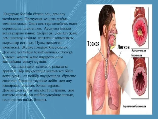 Қақырық бөлініп біткен соң, дем алу жеңілденеді. Прекуссия кезінде дыбыс