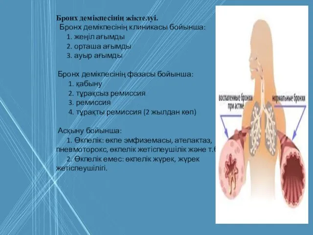 Бронх демікпесінің жіктелуі. Бронх демікпесінің клиникасы бойынша: 1. жеңіл ағымды